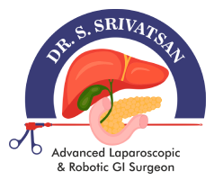 Robotic & Laparoscopic Surgeon in Chennai: Dr. S. Srivatsan Gurumurthy,Chennai, Tamil Nadu, India,Hospitals,Private Hospitals
