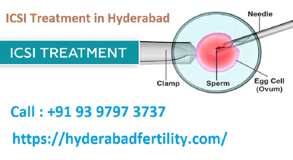 ICSI Treatment in Hyderabad,Hyderabad,Hospitals,Maternity Hospitals,77traders